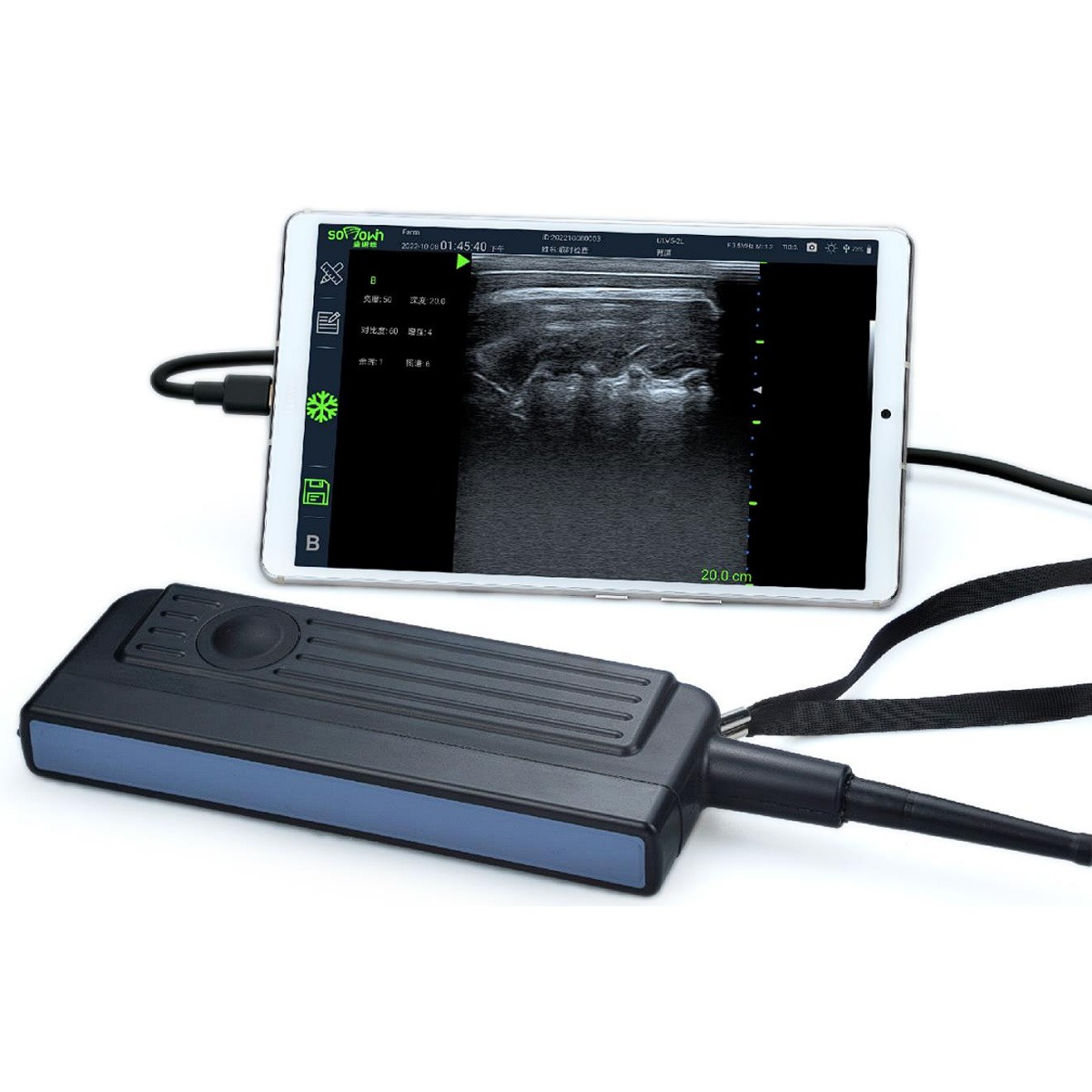 sonowin-fastscan